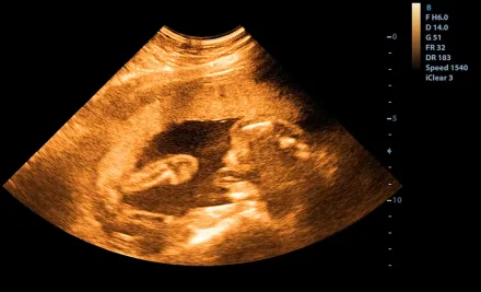أسعار أطفال الأنابيب في قبرص 2026: الرسوم الحالية ودليل شامل .