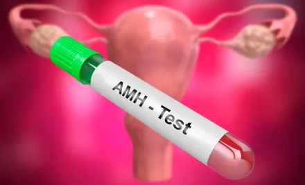 ما هو اختبار AMH؟ تأثيره على مخزون المبيض، خطر متلازمة فرط تحفيز المبيض (OHSS) وعلاج أطفال الأنابيب