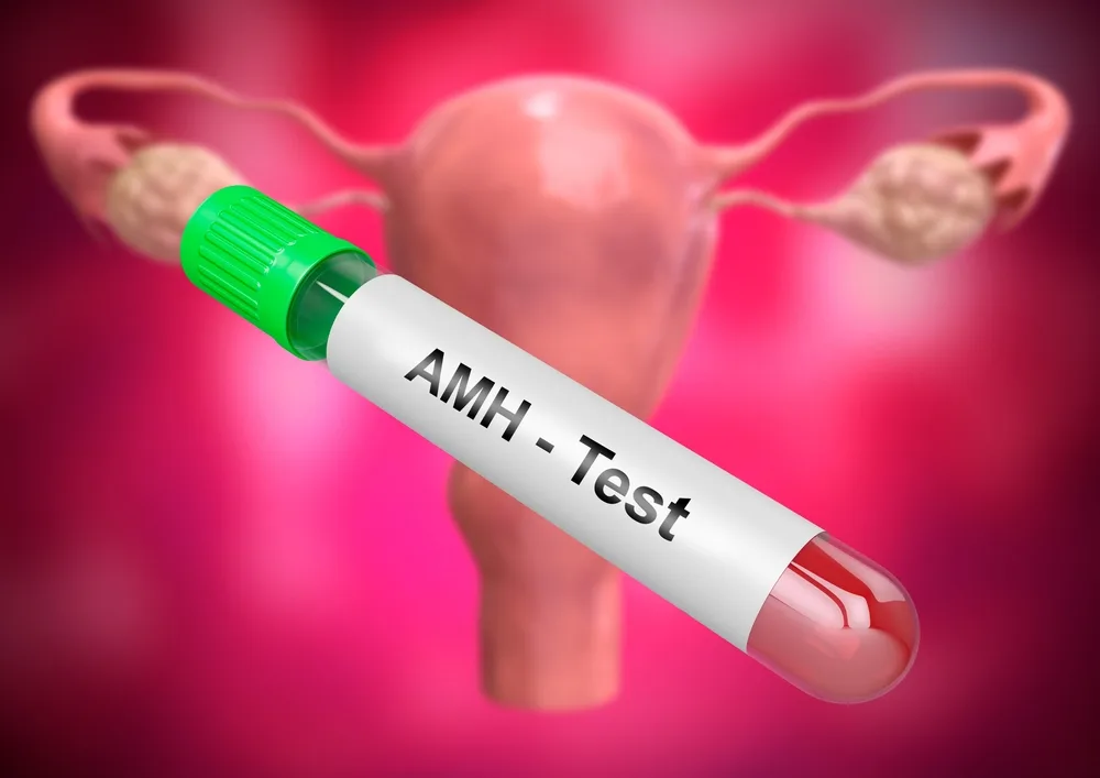 ما هو اختبار AMH؟ تأثيره على مخزون المبيض، خطر متلازمة فرط تحفيز المبيض (OHSS) وعلاج أطفال الأنابيب